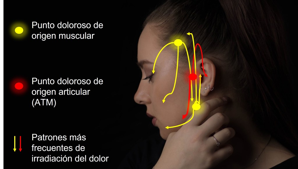 Dolor mandibular, dolor orofacial, trastorno temporomandibular, zaragoza, lleida, camilo, chavez Dolor mandibular, dolor orofacial, Camilo Chávez